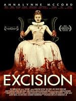 Excision posteri