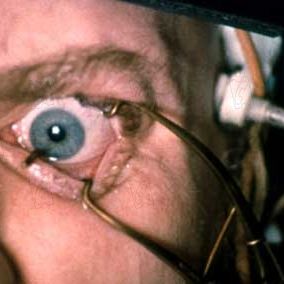 Fotoğraf Malcolm McDowell