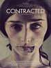 Contracted posteri